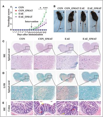 Oxymatrine ameliorates experimental autoimmune encephalomyelitis by rebalancing the homeostasis of gut microbiota and reducing blood-brain barrier disruption